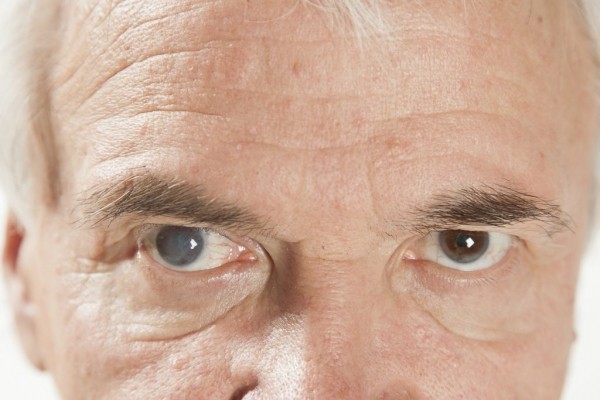 В каком возрасте развивается катаракта глаза и почему это болезнь пожилых