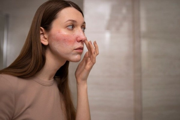 Косметолог Хлызова рассказала, при каких нарушениях появляются проблемы с кожей