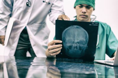 Тяжелая черепно-мозговая травма повышала риск развития злокачественной опухоли мозга