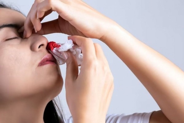 Врач Зиркуева: внезапное кровотечение из носа может означать проблемы с печенью