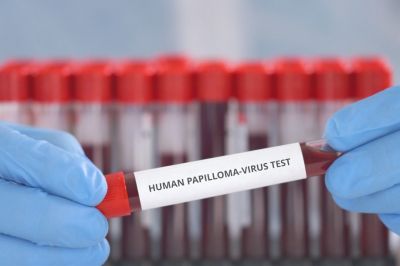 Скрининг на вирус папилломы человека превосходил мазок Папаниколау